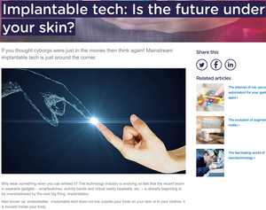Implantable tech: is the future under your Skin?
