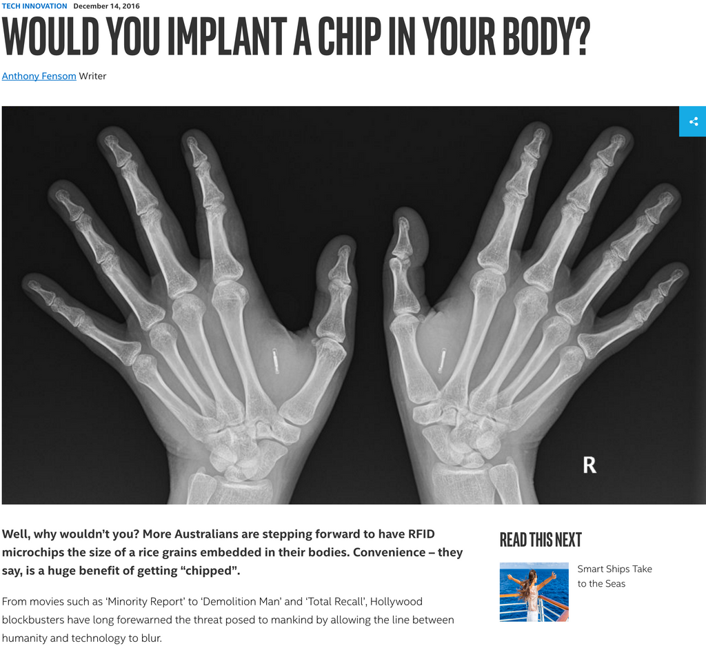 Would you implant a chip in your body?